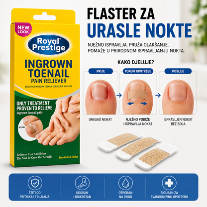 Flasteri za Urasle Nokte – Set od 80 komada